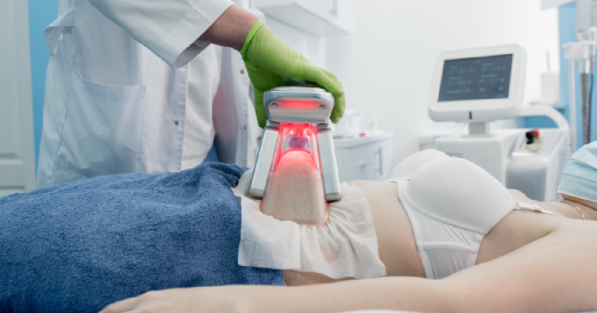 _Patient receiving ThermoShock fat reduction in Warren, NJ with a handheld red-light device on the abdomen in a medical spa.