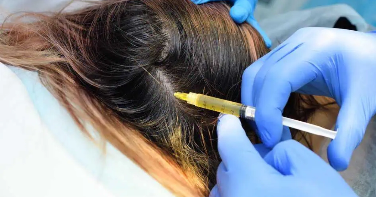 PRP vs Exosome therapy for hair restoration in Warren, NJ