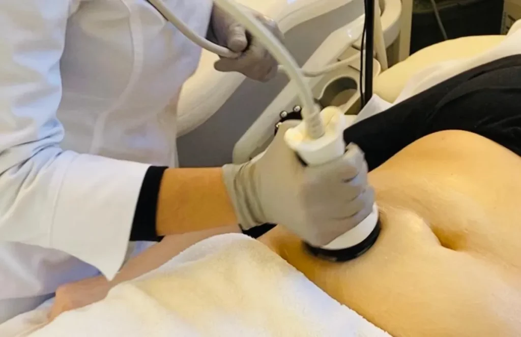Cavitation By FIRM Lab Warren in Warren NJ